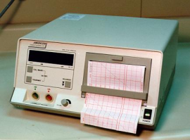 Indicators from a Fetal Monitor